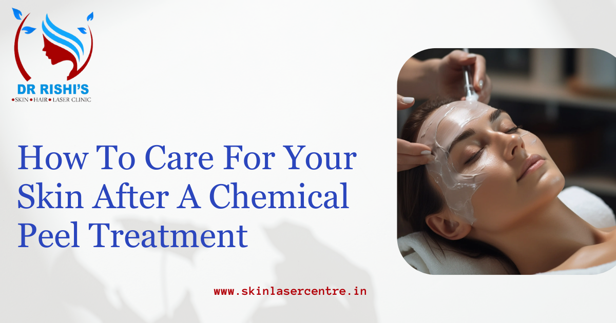 How To Care For Your Skin After A Chemical Peel Treatment